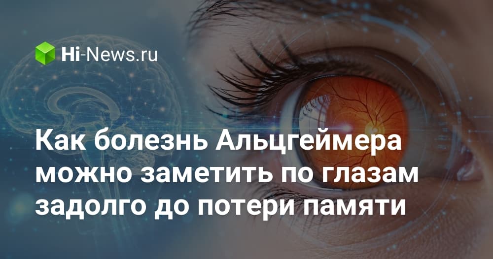 ИИ выявляет риск болезни Альцгеймера по снимкам сетчатки